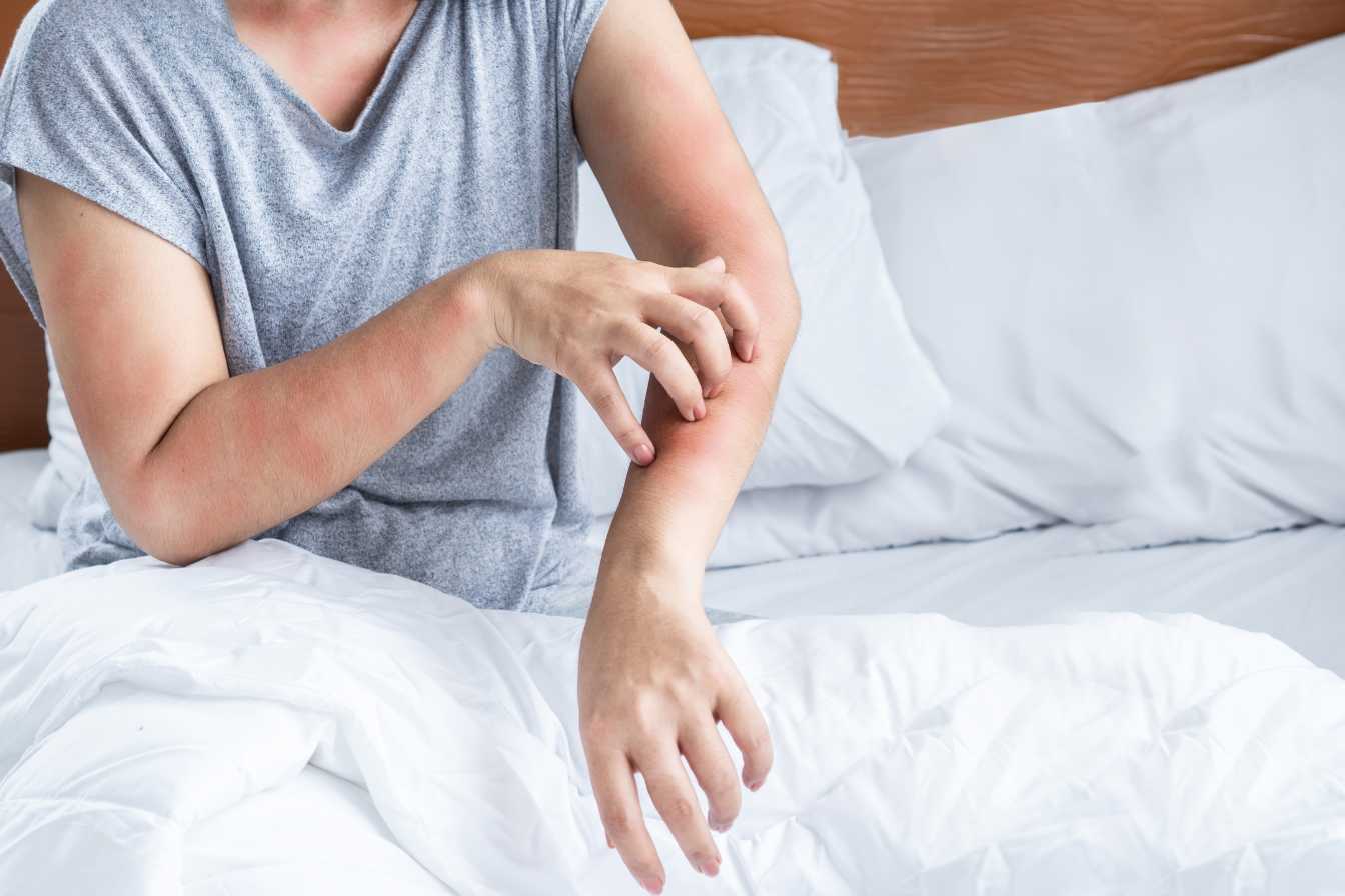 allergie-au-poivre-3