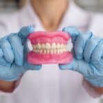 dents en resine capdentaire 1