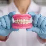 dents en resine capdentaire 1