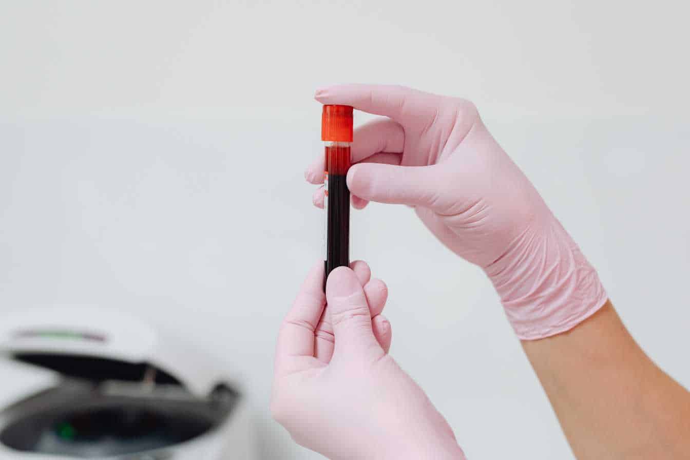 flector-pommade-anti-inflammatoire-sans-ordonnance-ce-que-vous-devez-absolument-savoir-2