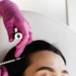 mesotherapie tout savoir sur cette technique anti age et anti douleur 1