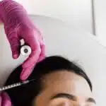 mesotherapie tout savoir sur cette technique anti age et anti douleur 1