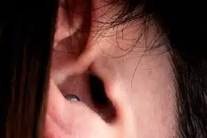 pourquoi les oreilles sifflent 1